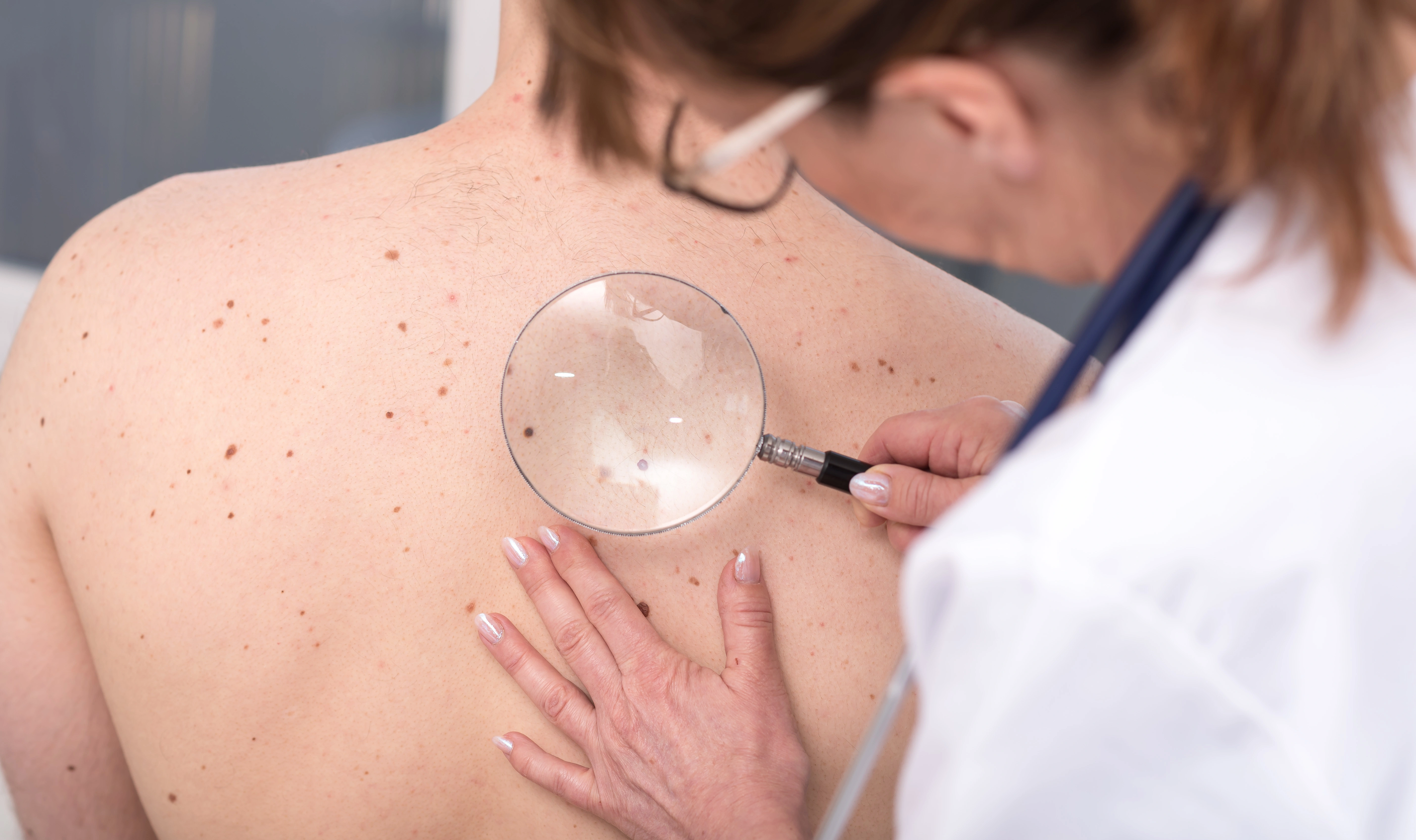 Dermatology